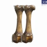 hueso femur